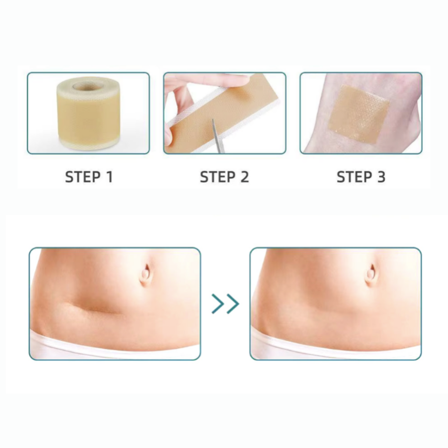 Auro™ Botox Tape