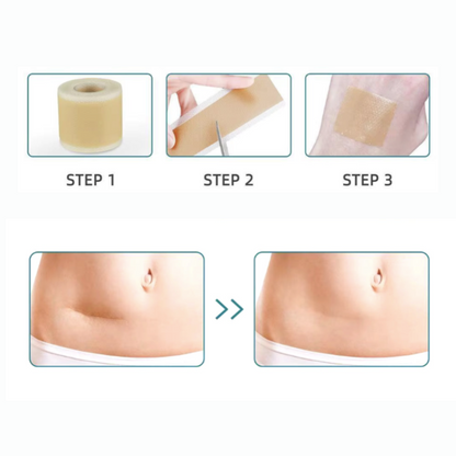 Auro™ Botox Tape